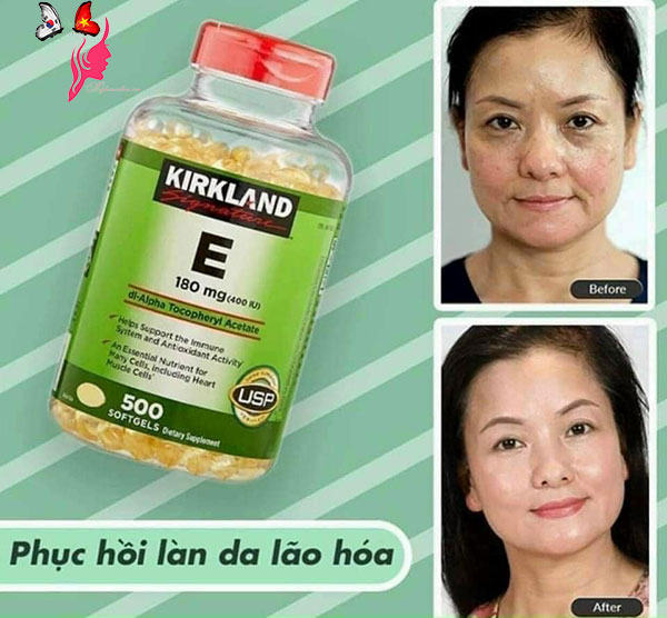 vien-uong-kirkland-vitamin-e-400-iu-500-vien-cua-my5